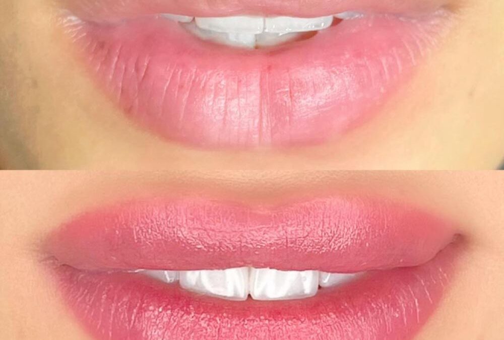 Micropigmentação Labial: Como Realçar a Cor Natural dos Lábios