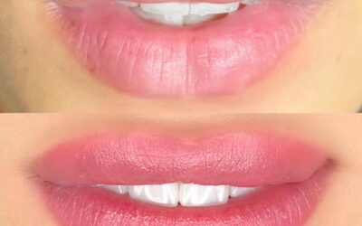 Micropigmentação Labial: Como Realçar a Cor Natural dos Lábios