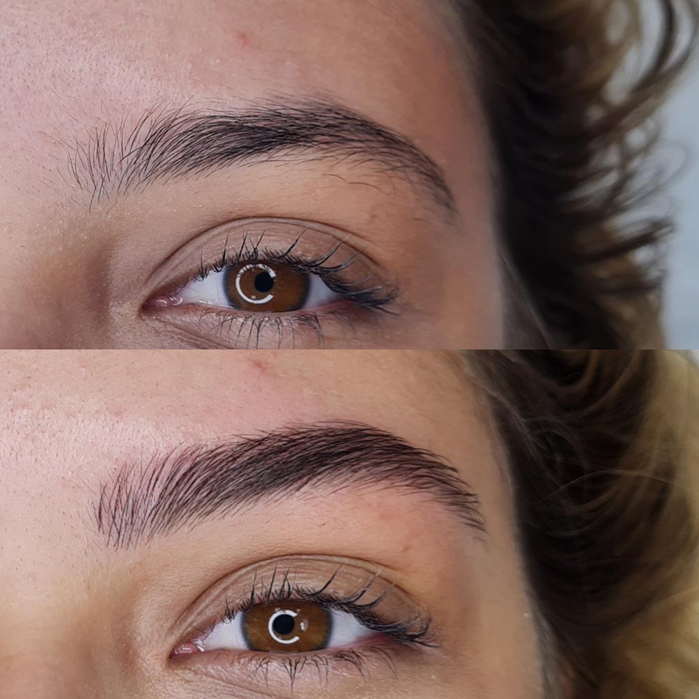 JS Brows – Nanoblading